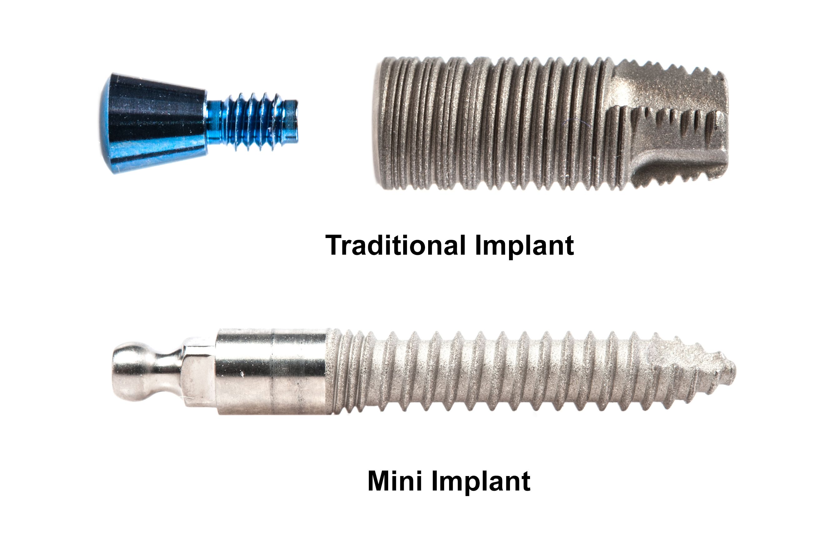 Size comparison of traditional and mini dental implants