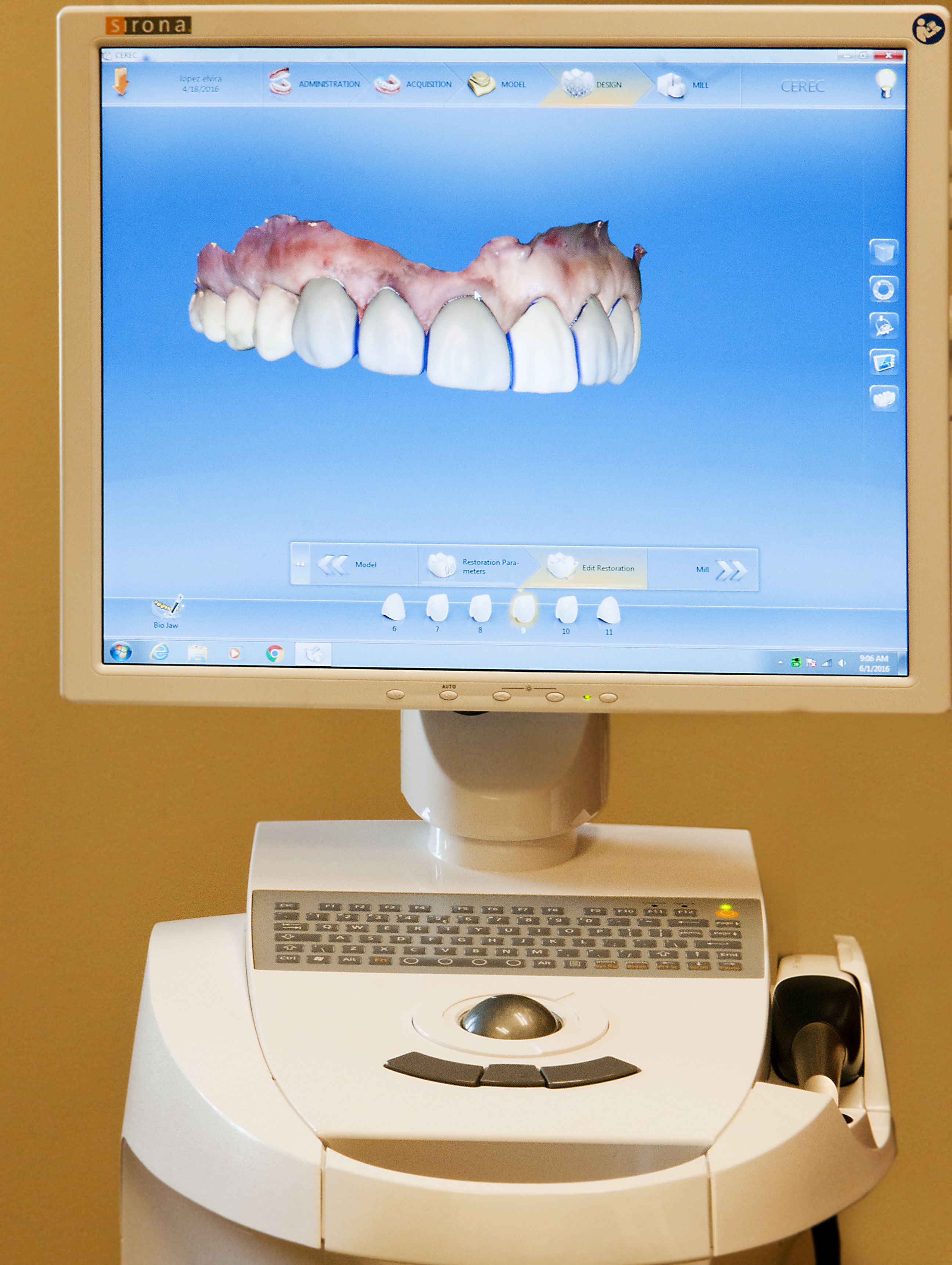 Same Day Dental Crowns Elkhart IN