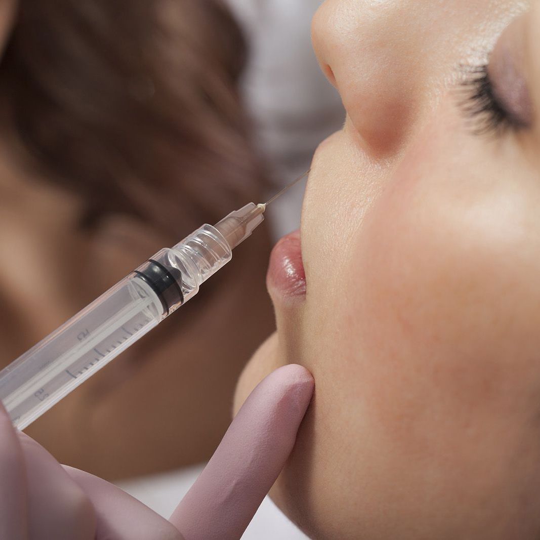 Woman receiving dermal fillers